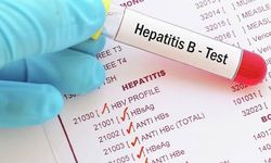 Uzmandan Hepatit B Uyarısı