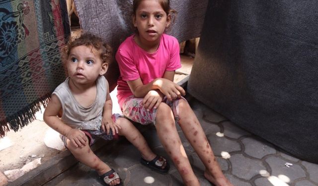 Gazze’de suçiçeği vakaları alarm seviyesinde: İki haftada 9 bin 300 vaka bildirildi