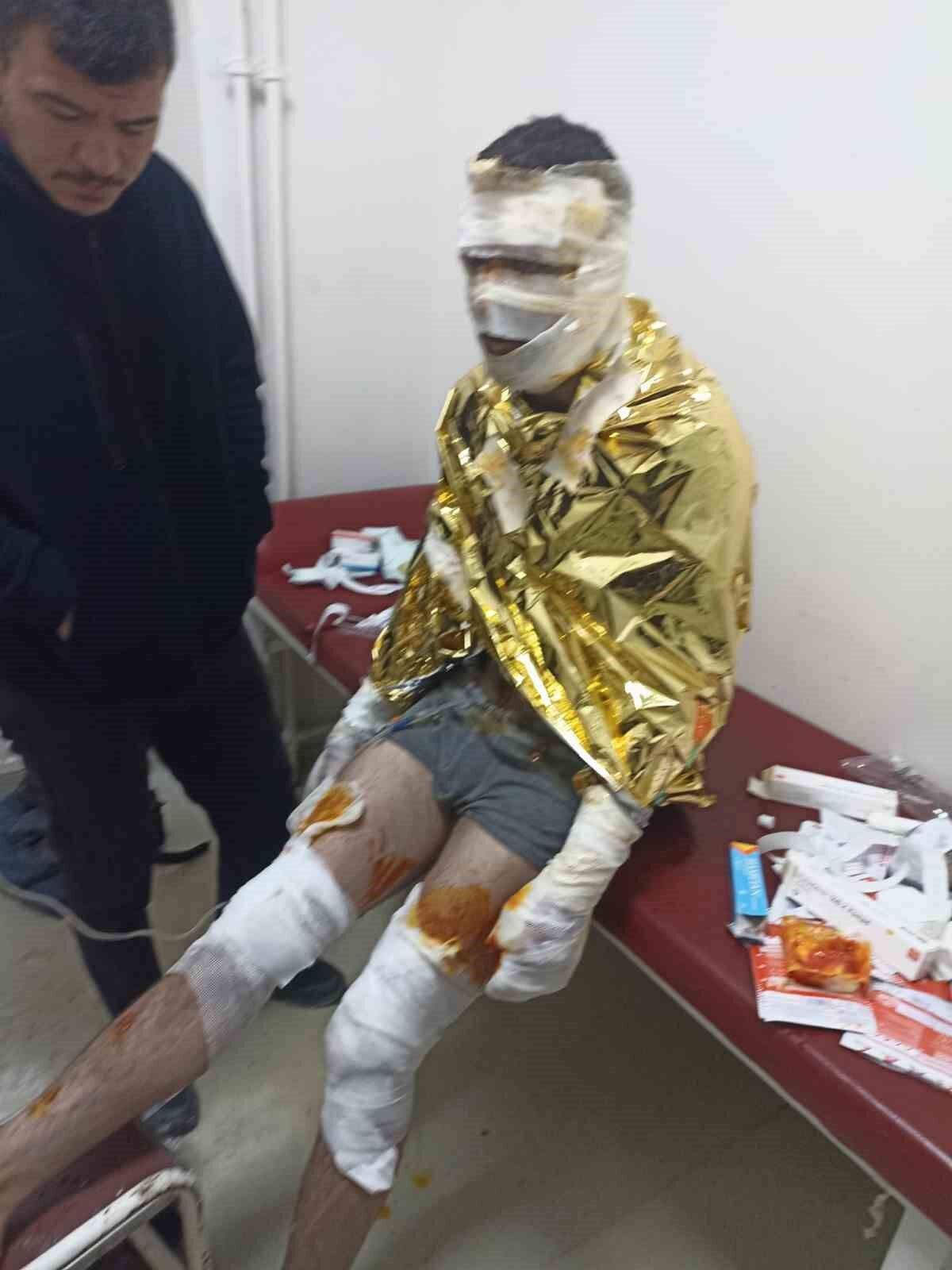 Erzincan’da kömür ocağında yangın: 2 işçi yaralı